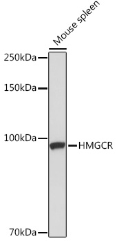 Anti-HMGCR Antibody (CAB1633)