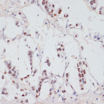 Anti-Phospho-SRF-S103 pAb (CABP0829)