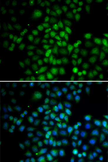 Anti-C11orf30 Antibody (CAB13643)