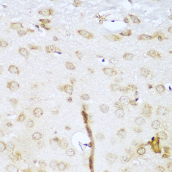 Anti-UBE2L3 Antibody (CAB4175)