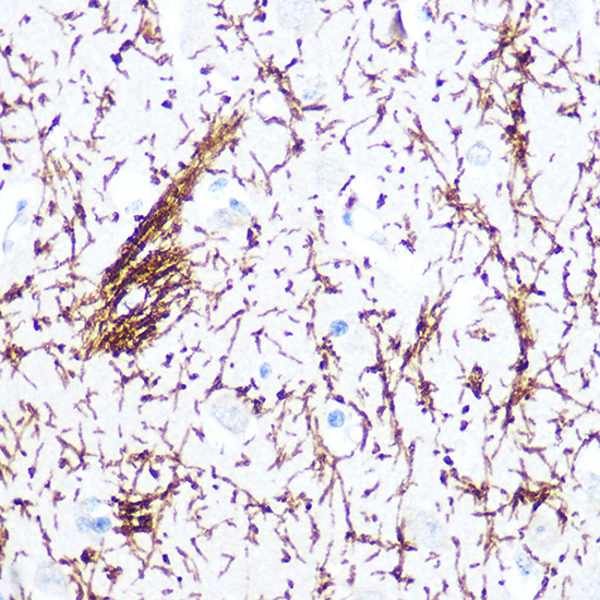 Anti-Myelin Basic protein Antibody (CAB1664)