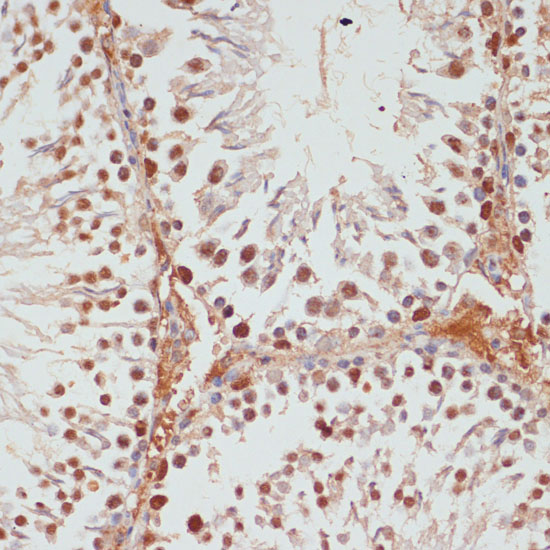 Anti-PARP1 Antibody (CAB0010)