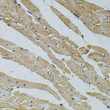 Anti-TRPV3 Antibody (CAB12613)