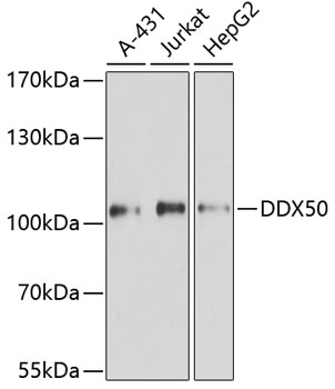 Anti-DDX50 Polyclonal Antibody (CAB8628)