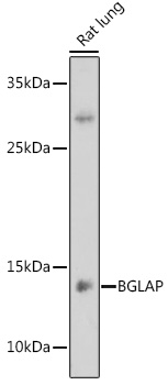 Anti-BGLAP Antibody (CAB6205)