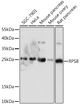 Anti-RPS8 Antibody (CAB18377)