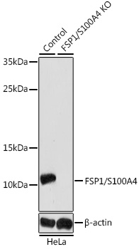 Anti-FSP1/S100A4 Antibody [KO Validated] (CAB1631)