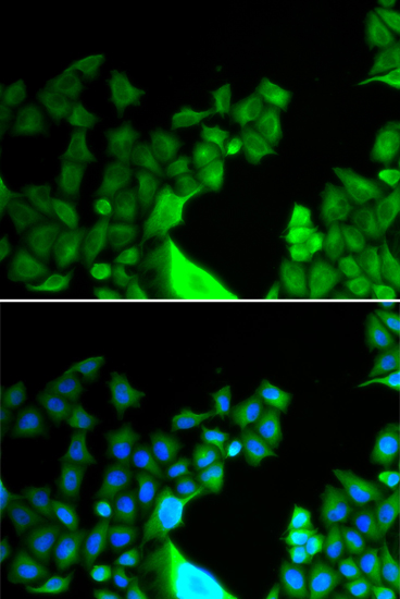 Anti-BCL2L14 Antibody (CAB6478)