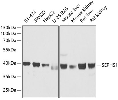 Anti-SEPHS1 Antibody (CAB13403)