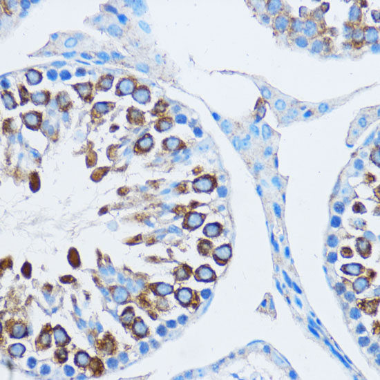 Anti-YBX1 Antibody [KO Validated] (CAB7704)