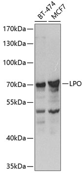 Anti-Lactoperoxidase Polyclonal Antibody (CAB8053)