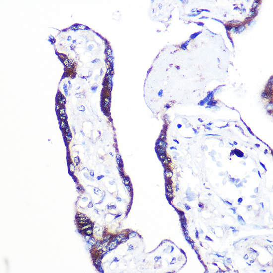 Anti-PEX2 Antibody (CAB15308)