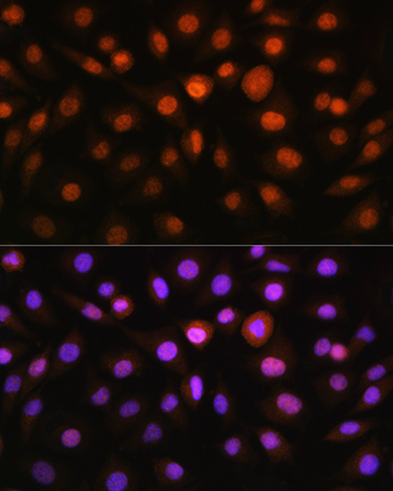 Anti-DDIT3 / CHOP Antibody (CAB0221)