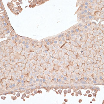 Anti-KIAA1524 Antibody (CAB12267)