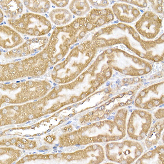 Immunohistochemistry of paraffin-embedded mouse kidney using USP9Y Rabbit pAb at dilution of 1:150 (40x lens). Perform high pressure antigen retrieval with 10 mM citrate buffer pH 6. 0 before commencing with IHC staining protocol.