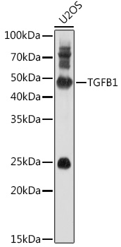 Anti-TGFB1 Antibody (CAB16640)