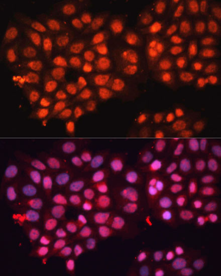 Anti-ABCB8 Antibody (CAB2653)