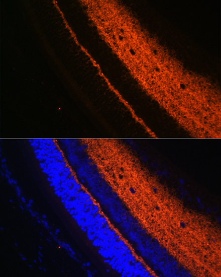 Anti-SYT1 Antibody (CAB0992)