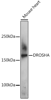 Anti-Ribonuclease 3 Polyclonal Antibody (CAB8336)