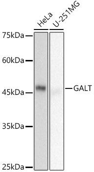 Western blot analysis of extracts of various cell lines, using GALT antibody at 1:500 dilution. Secondary antibody: HRP Goat Anti-Rabbit IgG (H+L) at 1:10000 dilution. Lysates/proteins: 25ug per lane. Blocking buffer: 3% nonfat dry milk in TBST. Detection: ECL Basic Kit. Exposure time: 10s.