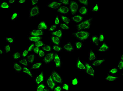 Anti-HSD3B2 Antibody (CAB1823)