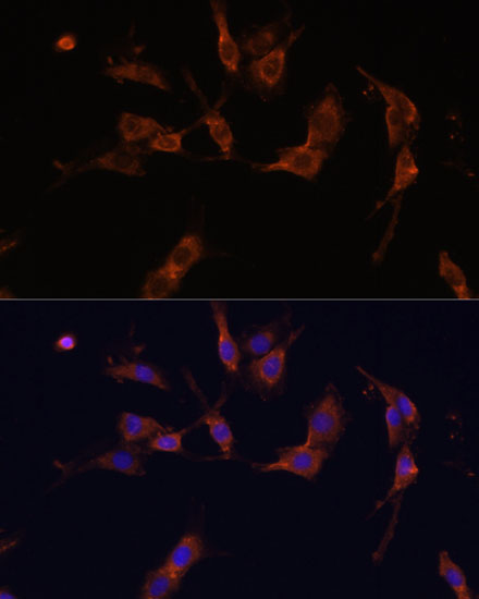 Anti-IQGAP1 Antibody (CAB5679)