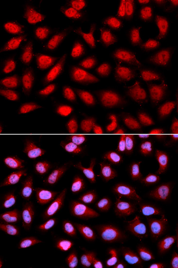 Anti-PPP2R4 Antibody (CAB1912)