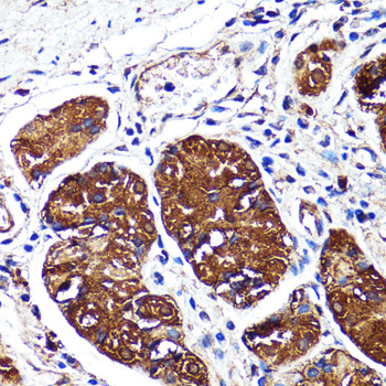 Anti-CNR2 Antibody (CAB1762)