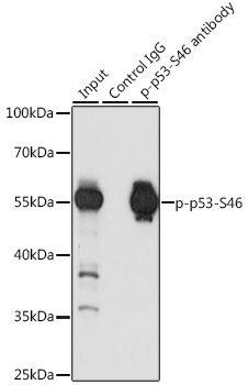 Anti-Phospho-p53-S46 Antibody (CABP0476)