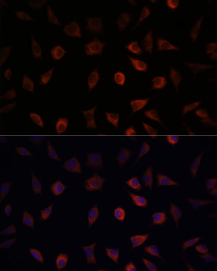 Anti-FABP1 Antibody (CAB5311)