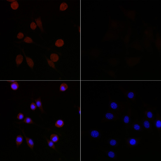 Anti-MAP1LC3B Mouse Monoclonal Antibody (CAB17424)