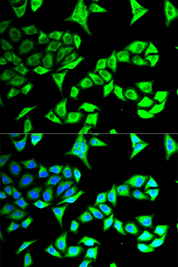 Anti-GABARAP Antibody (CAB5616)