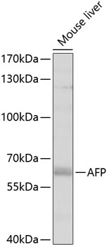 Anti-AFP Antibody (CAB11013)