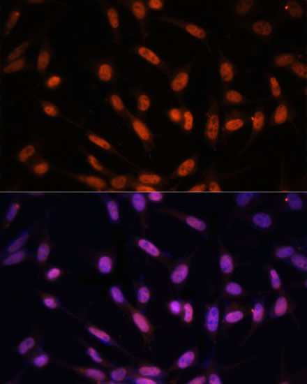 Anti-Twist Antibody (CAB7314)