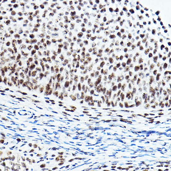 Anti-PAXIP1 Antibody (CAB17431)