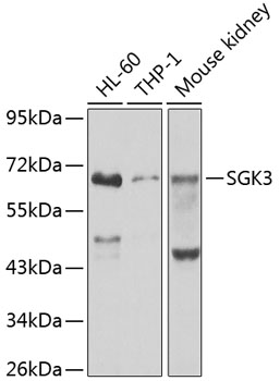 Anti-SGK3 Antibody (CAB7586)