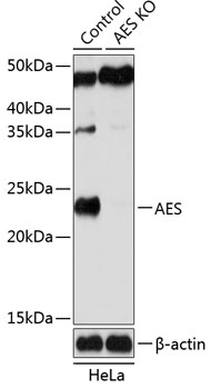 Anti-AES Antibody [KO Validated] (CAB19944)