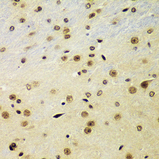 Anti-RING1B/RNF2 Antibody (CAB5563)