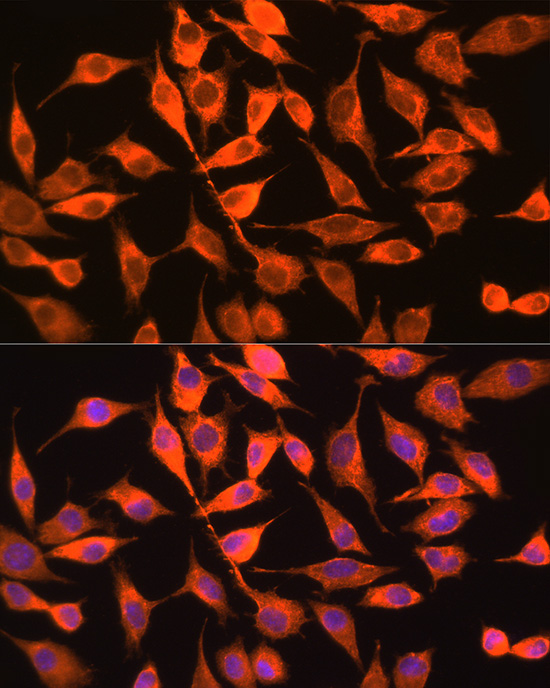 Anti-PITPNA Antibody (CAB12966)