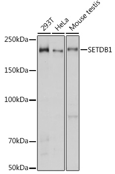 Anti-SETDB1 Antibody [KO Validated] (CAB6145)