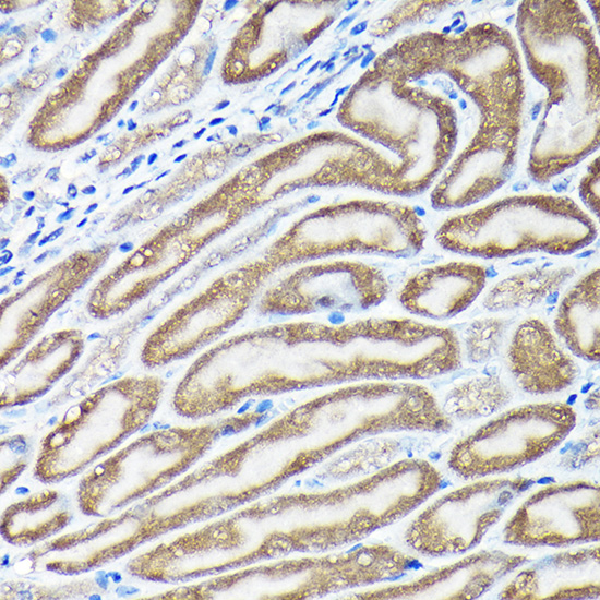 Anti-NRF2 Antibody (CAB11159)