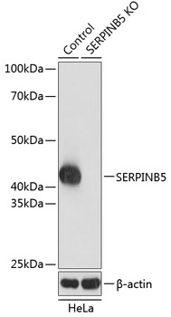 Anti-SERPINB5 Antibody [KO Validated] (CAB19848)