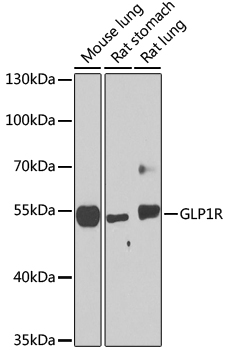 Anti-GLP1R Polyclonal Antibody (CAB8547)