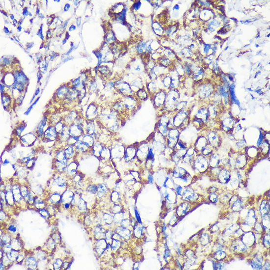 Anti-MRPS35 Antibody (CAB15878)