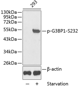 Anti-Phospho-G3BP1-S232 Antibody (CABP0352)