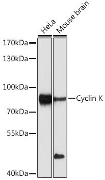 Anti-Cyclin K Antibody (CAB10261)