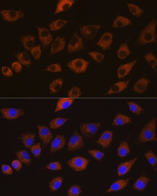 Anti-DLG1 Polyclonal Antibody (CAB8542)