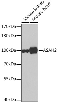 Anti-Neutral ceramidase Polyclonal Antibody (CAB7985)