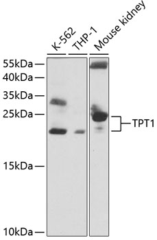 Anti-TPT1 Antibody (CAB13367)