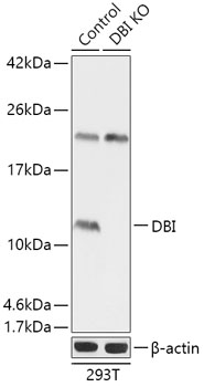 Anti-DBI Antibody [KO Validated] (CAB18024)